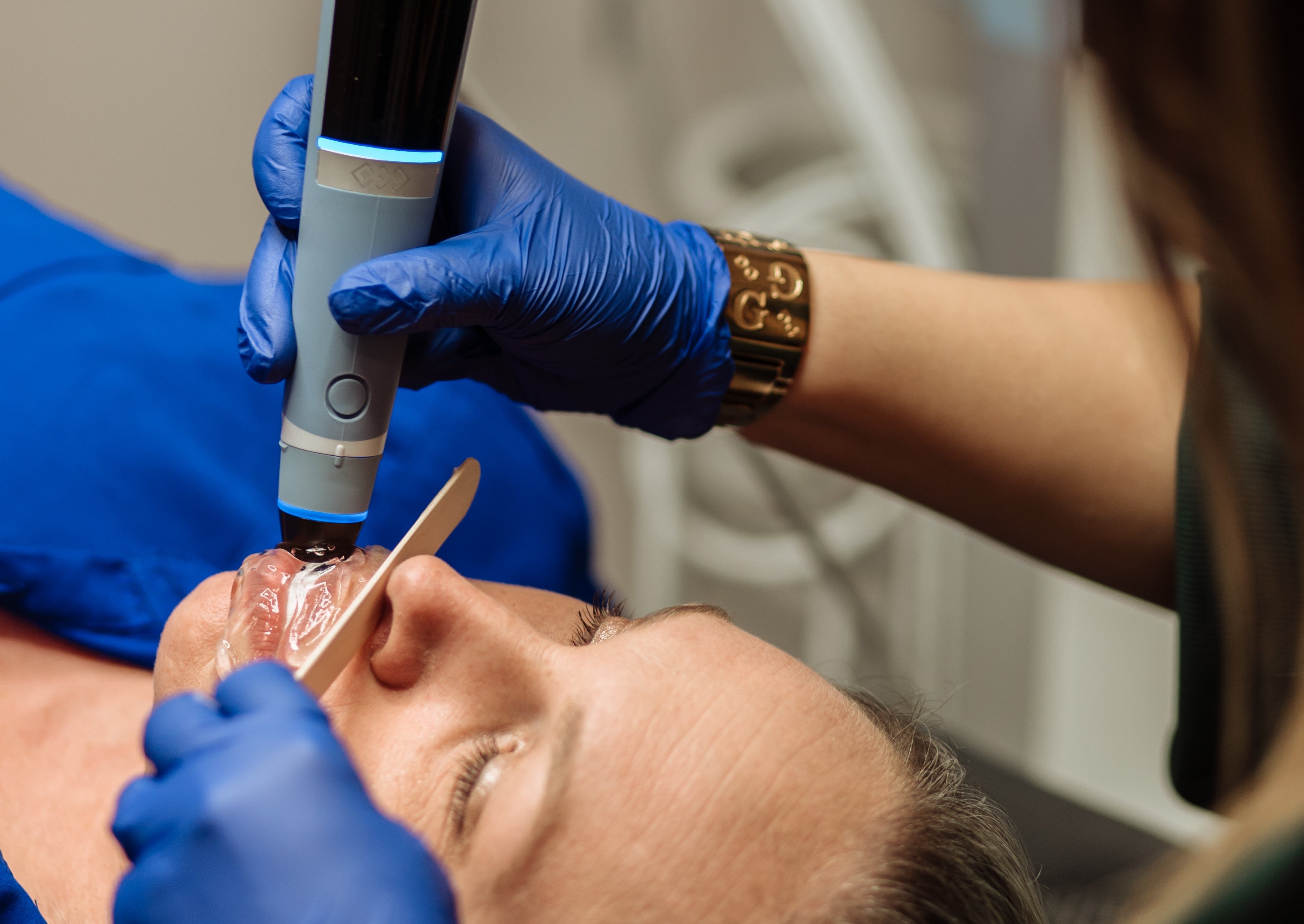 Lip Filler Without the Needles: Why Everyone’s Talking About Exion HA™
