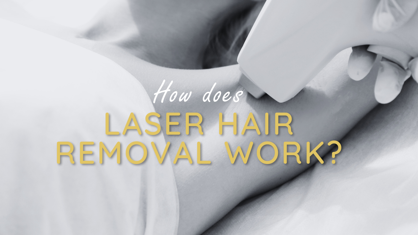 Laser Hair Removal for Summer