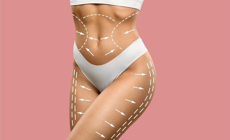 A woman with white arrows on her body, representing lifting and tightening treatment