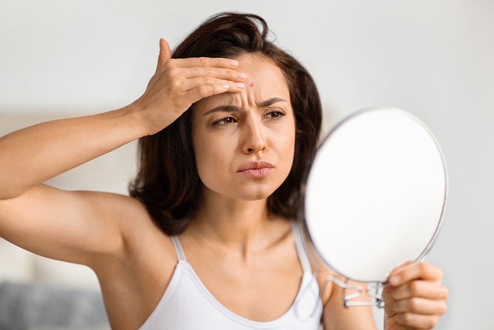 What Causes Forehead Wrinkles in Women?